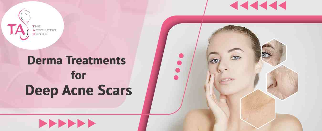 Best Derma Treatments for Deep Acne Scars in India